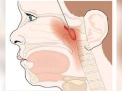 Anosmia Tak Boleh Disepelekan, Ini Kata Dokter THT Bojonegoro