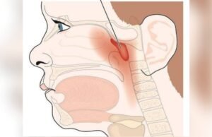 Anosmia Tak Boleh Disepelekan, Ini Kata Dokter THT Bojonegoro