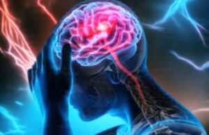 Dokter Saraf Bojonegoro Beber Rahasia Otak Tetap Tajam Hingga Tua