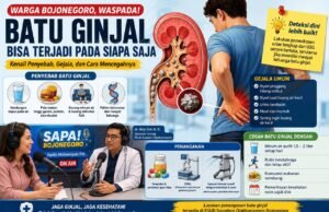 Dokter RSUD Bojonegoro Beberkan Cara Cegah Batu Ginjal Sebelum Terlambat